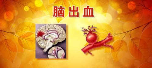 养生堂曹勇警惕另类脑出血-别有病 Byb.cn-纯自然疗法 攻克亚健康